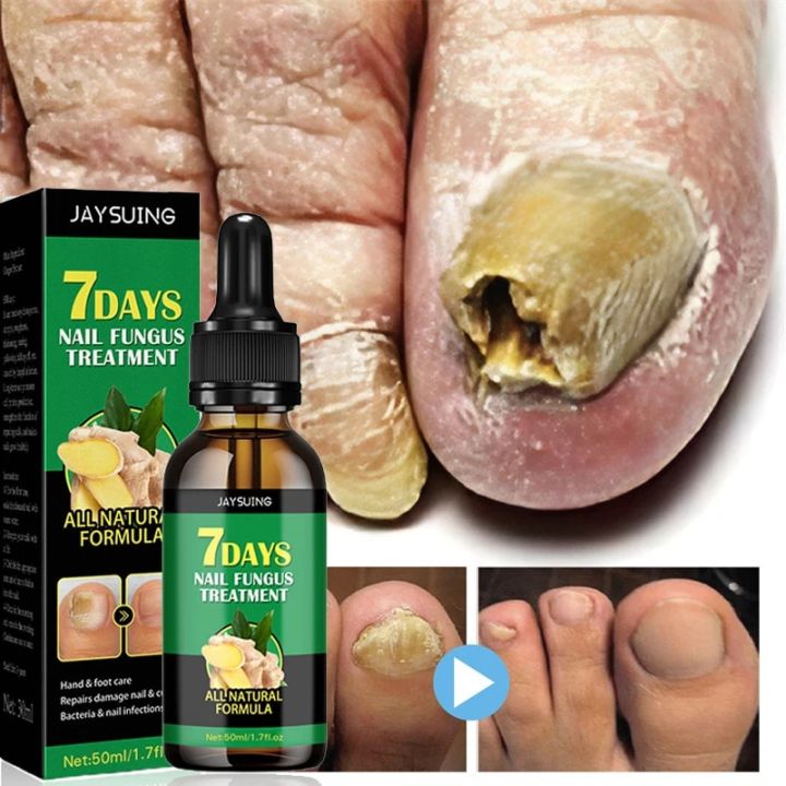 Nail Fungus Treatment Serum